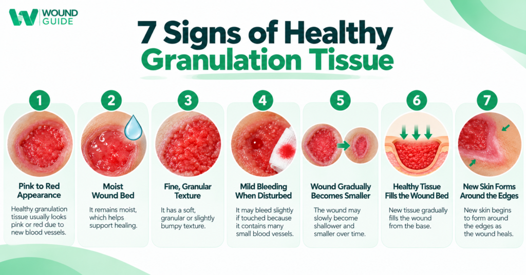 7 signs of healthy granulation tissue in wounds including pink to red appearance, moist wound bed, granular texture, gradual wound healing and new skin formation
