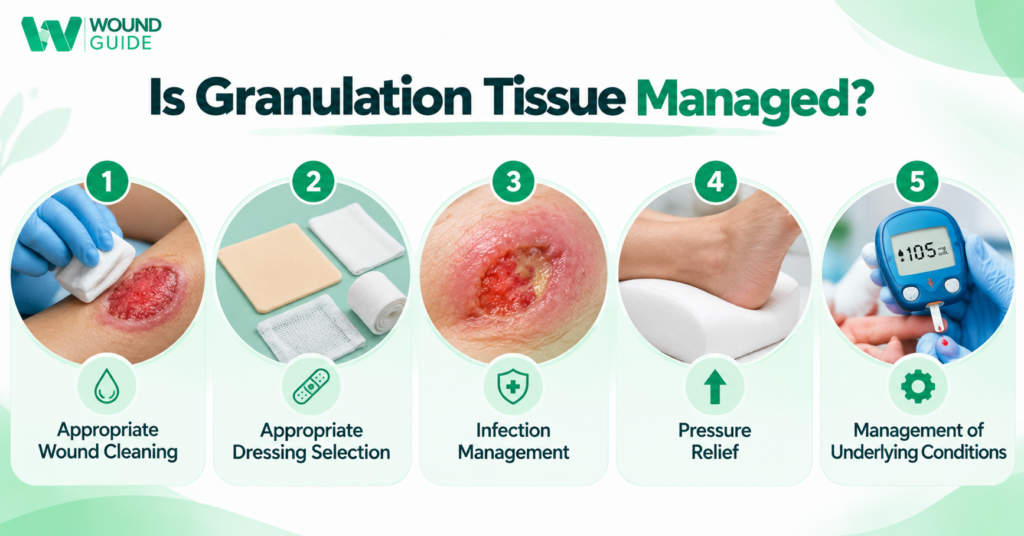 Granulation tissue management showing wound cleaning, dressing selection, infection management, pressure relief and underlying condition care