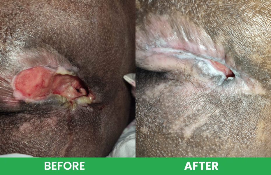 bedsore - Before vs After