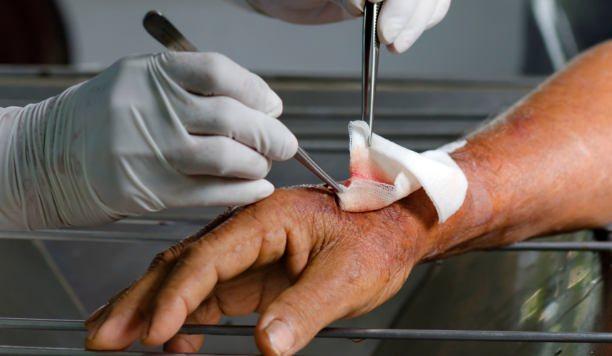 Chronic Non-Healing Wounds Chronic Non-Healing Wounds: Causes, Symptoms, and Treatment Options