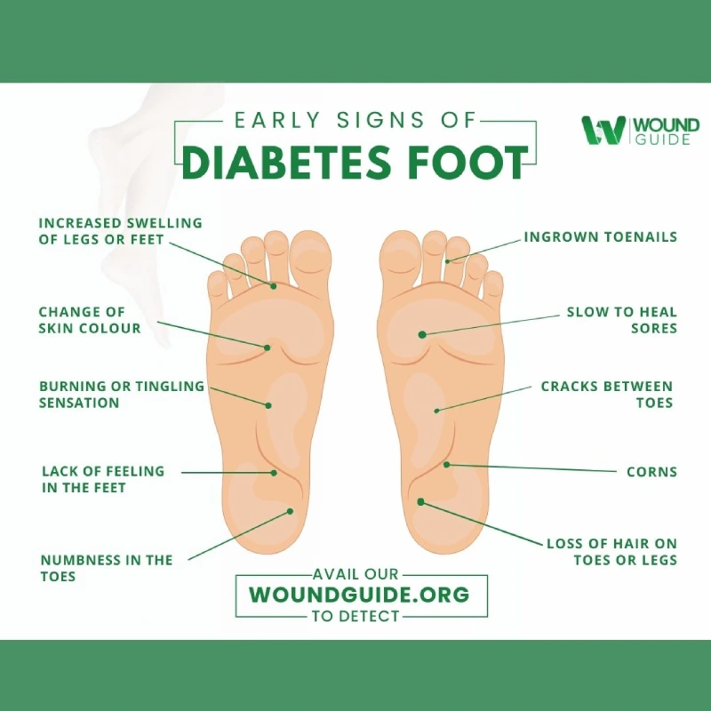 early signs of diabetic foot ulcer