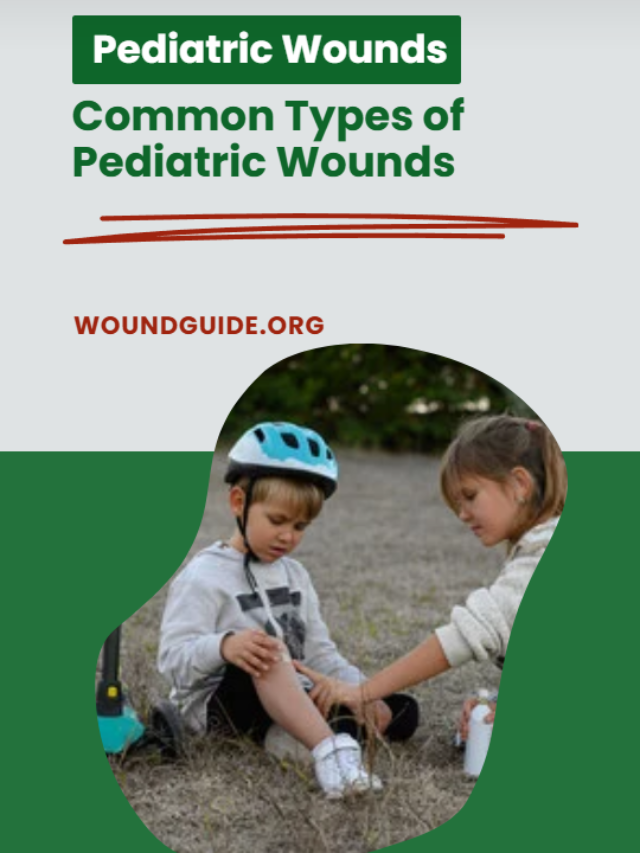 Types of Pediatric Wounds & Treatment: Quick Guide