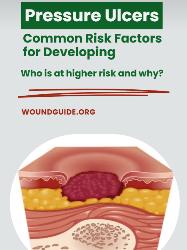 Common Risk Factors For Developing Pressure