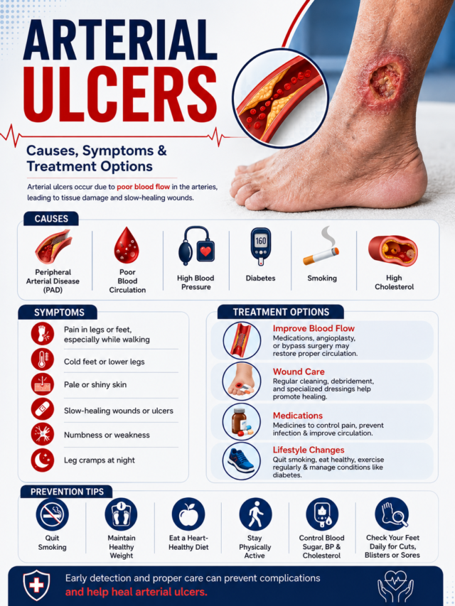 Arterial Ulcers: Causes, Symptoms & Treatment Options