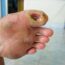 Diabetic Foot Infection symptoms including redness, swelling and wound drainage