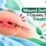 Surgical wound dehiscence showing an open incision with stitches and surrounding redness.
