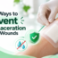 Wound dressing and moisture management to help prevent skin maceration around wounds.